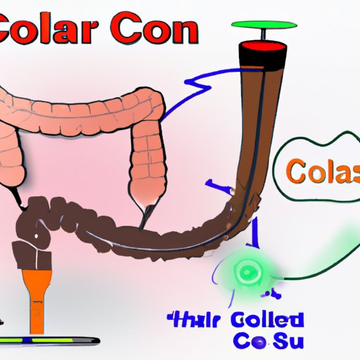 Exploring the Process of a Colonoscopy: What It Is and How It Works