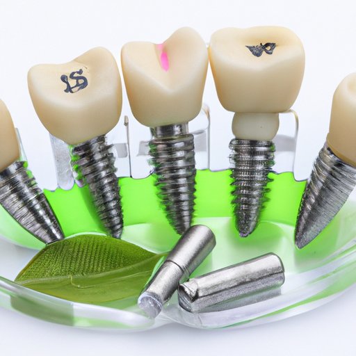 Overview of Clear Choice Dental Implants