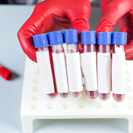 Exploring The Significance Of A Culture Test For Blood The 