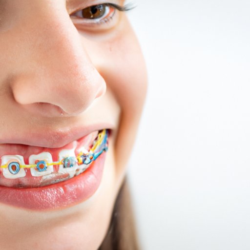 The History of Braces: How the Invention of Braces has Evolved Over ...