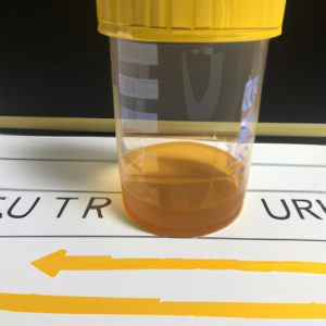 What is Urinalysis with Reflex Culture? Benefits, Process and Common ...